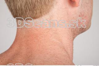 Neck texture of Alberto 0001